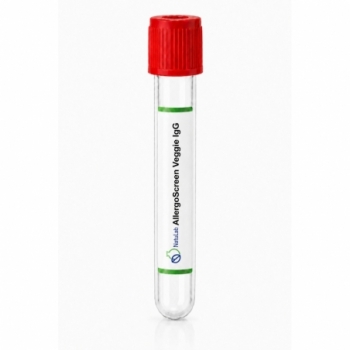 AllergoScreen Veggie – Uitgebreid IgG-voedingsmiddelenprofiel (223 voedingsmiddelen)
